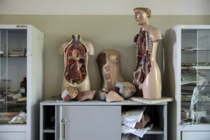 Alcoholic Hepatitis Symptoms, Diagnosis, and Treatment Strategies for Liver Recovery