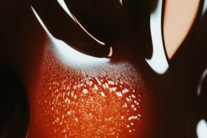 Understanding Liver Fibrosis and How It Differs from Cirrhosis in Development